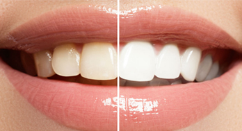 Unveiling 7 Secret Benefits of Teeth Whitening