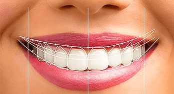 The Numerous Benefits of Smile Designing in Thiruvalla