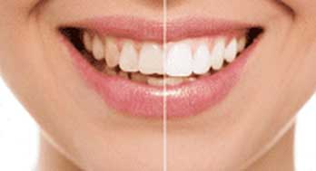 Transform Your Smile with Expert Care at Dr. Pradeep’s Dental Clinic Thiruvalla