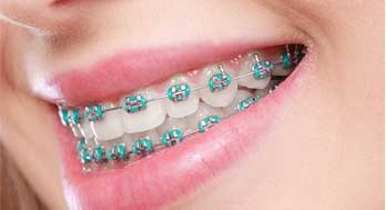 Your Trusted Choice When Searching for a Dental Clinic Near Me – Dr. Pradeep Dental Clinic, Thiruvalla