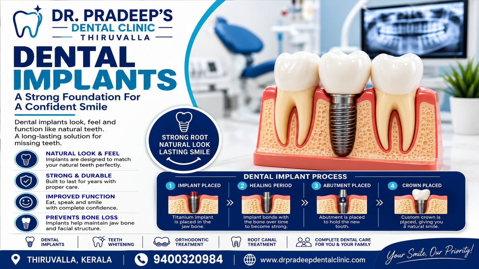 Dental Implant in Thiruvalla – Restore Your Smile with Dr. PRADEEP’S DENTAL CLINIC