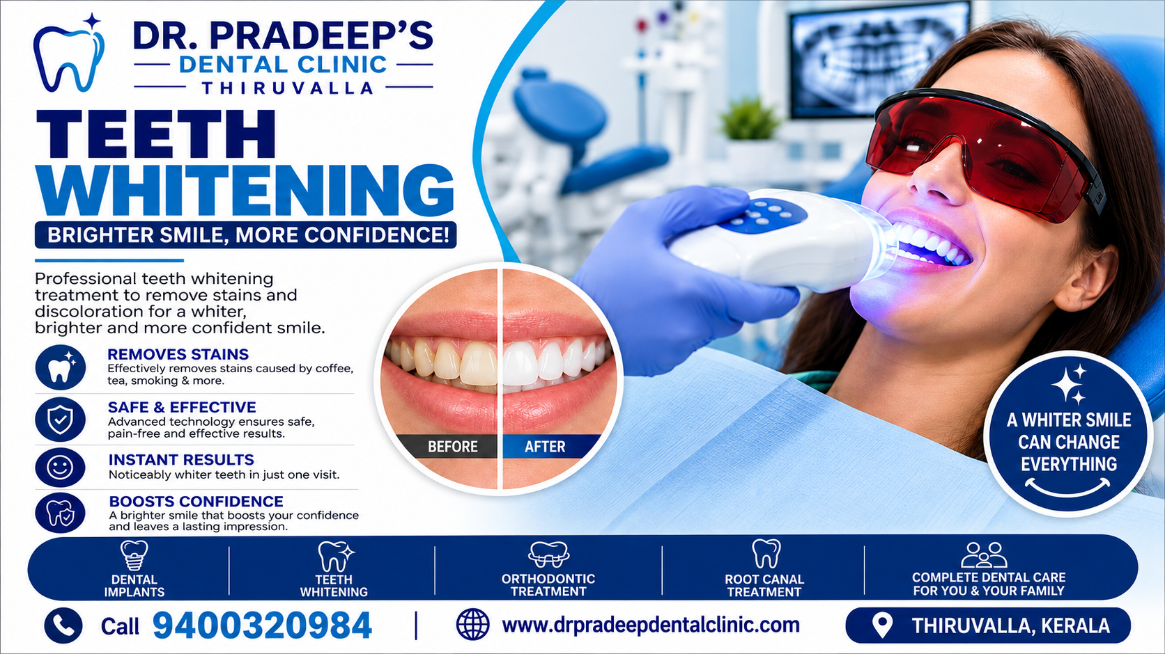 Teeth Whitening in Thiruvalla – Brighten Your Smile with Dr. PRADEEP’S DENTAL CLINIC
